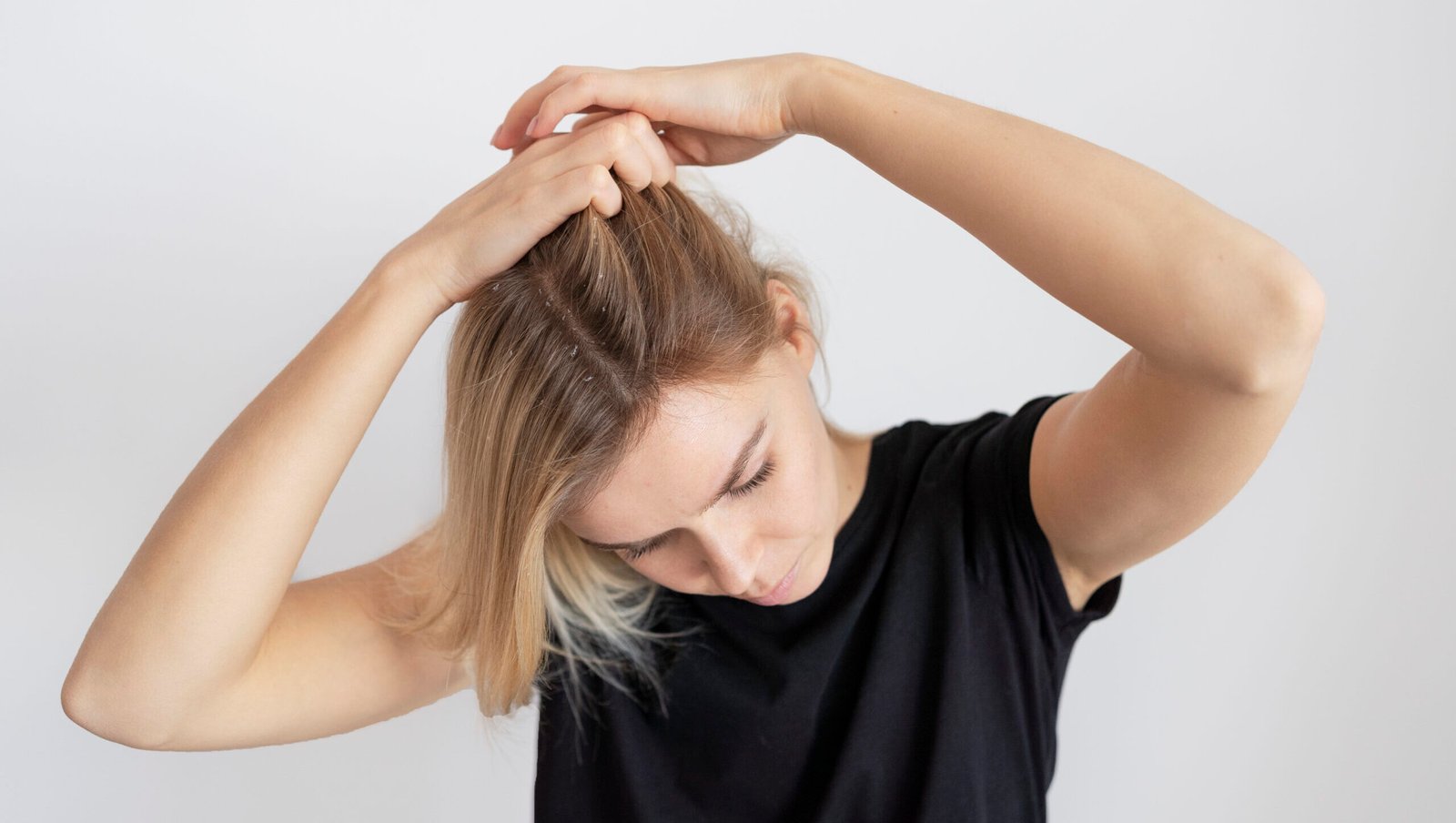 Cuir Chevelu Sensible : Causes, Symptômes et Solutions pour Apaiser Durablement 2026